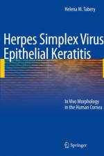 Herpes Simplex Virus Epithelial Keratitis af Helena M. Tabery