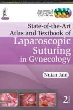 State-of-the-Art Atlas and Textbook of Laparoscopic Suturing in Gynecology