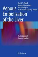 Venous Embolization of the Liver