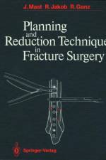Planning and Reduction Technique in Fracture Surgery af Jeffrey Mast
