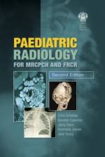Paediatric Radiology for MRCPCH and FRCR, Second Edition af Christopher Schelvan
