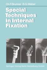 Special Techniques in Internal Fixation af B. G. Weber