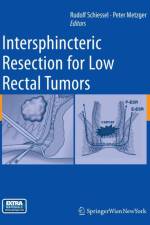 Intersphincteric Resection for Low Rectal Tumors