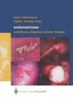 Endometriose af Thomas Steck