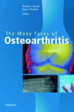 Many Faces of Osteoarthritis