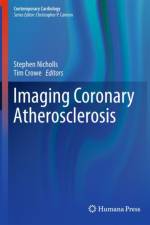 Imaging Coronary Atherosclerosis