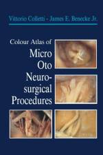 Colour Atlas of Micro-Oto-Neurosurgical Procedures af James E. Jr. Benecke