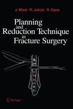 Planning and Reduction Technique in Fracture Surgery