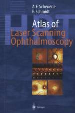 Atlas of Laser Scanning Ophthalmoscopy af Eckart Schmidt
