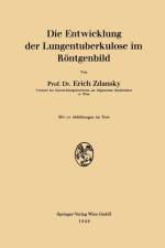 Die Entwicklung Der Lungentuberkulose Im Roentgenbild af Erich Zdansky