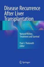 Disease Recurrence After Liver Transplantation