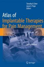 Atlas of Implantable Therapies for Pain Management