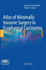 Atlas of Minimally Invasive Surgery in Esophageal Carcinoma