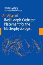 Atlas of Radioscopic Catheter Placement for the Electrophysiologist