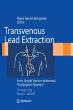 Transvenous Lead Extraction