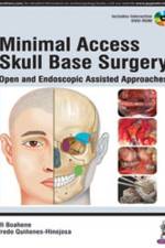 Minimal Access Skull Base Surgery