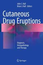 Cutaneous Drug Eruptions
