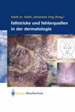Fallstricke Und Fehlerquellen in Der Dermatologie