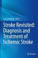 Stroke Revisited: Diagnosis and Treatment of Ischemic Stroke