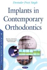 Implants in Contemporary Orthodontics af Dr Devinder Preet