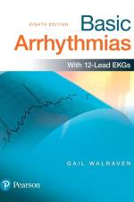 Basic Arrhythmias af Gail Walraven