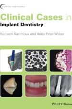 Clinical Cases in Implant Dentistry af N Karimbux