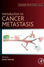 Introduction to Cancer Metastasis