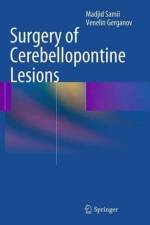 Surgery of Cerebellopontine Lesions af Madjid Samii