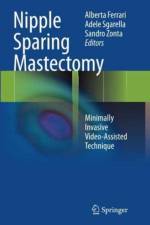 Nipple Sparing Mastectomy