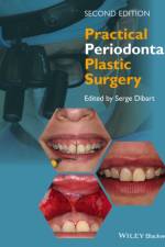 Practical Periodontal Plastic Surgery af S Dibart