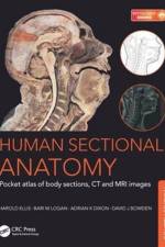 Human Sectional Anatomy af Bari M. (Formerly University Prosector Logan