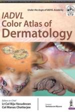IADVL Color Atlas of Dermatology af Biju Vasudevan