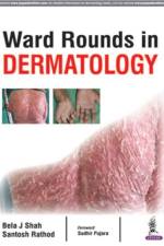Ward Rounds in Dermatology af Bela J Shah