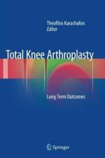 Total Knee Arthroplasty
