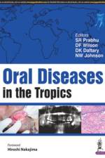 Oral Diseases in the Tropics af S R Prabhu