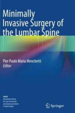 Minimally Invasive Surgery of the Lumbar Spine
