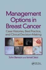 Management Options in Breast Cancer