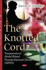 Knotted Cord af Kieran D O'Malley