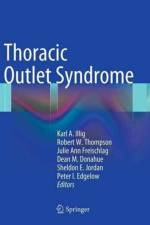 Thoracic Outlet Syndrome