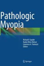 Pathologic Myopia