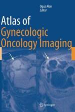 Atlas of Gynecologic Oncology Imaging