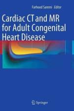 Cardiac CT and MR for Adult Congenital Heart Disease