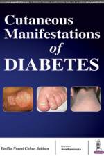 Cutaneous Manifestations of Diabetes af Cohen Sabban Emilia