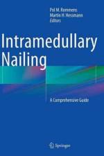 Intramedullary Nailing