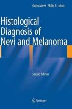 Histological Diagnosis of Nevi and Melanoma af Guido Massi