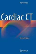 Cardiac CT af Marc Dewey
