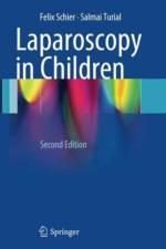 Laparoscopy in Children af Felix Schier