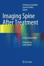 Imaging Spine After Treatment