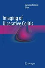 Imaging of Ulcerative Colitis