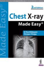 Chest X-ray Made Easy af D. Karthikeyan